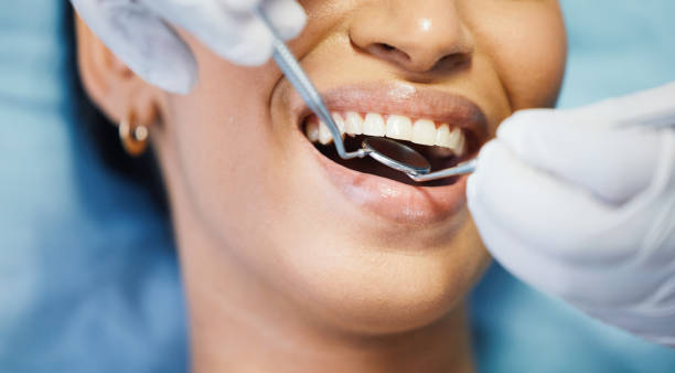 Best Emergency Wisdom Tooth Extraction in Melville, NY