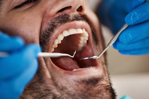 Best Dental Abscess Treatment in Melville, NY